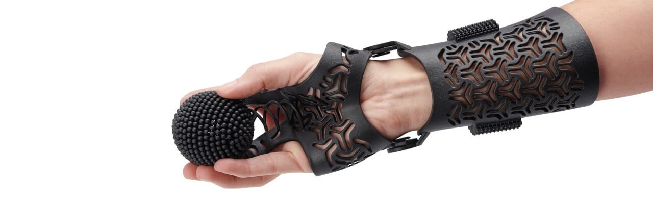 3D printed arm orthosis by Heygears